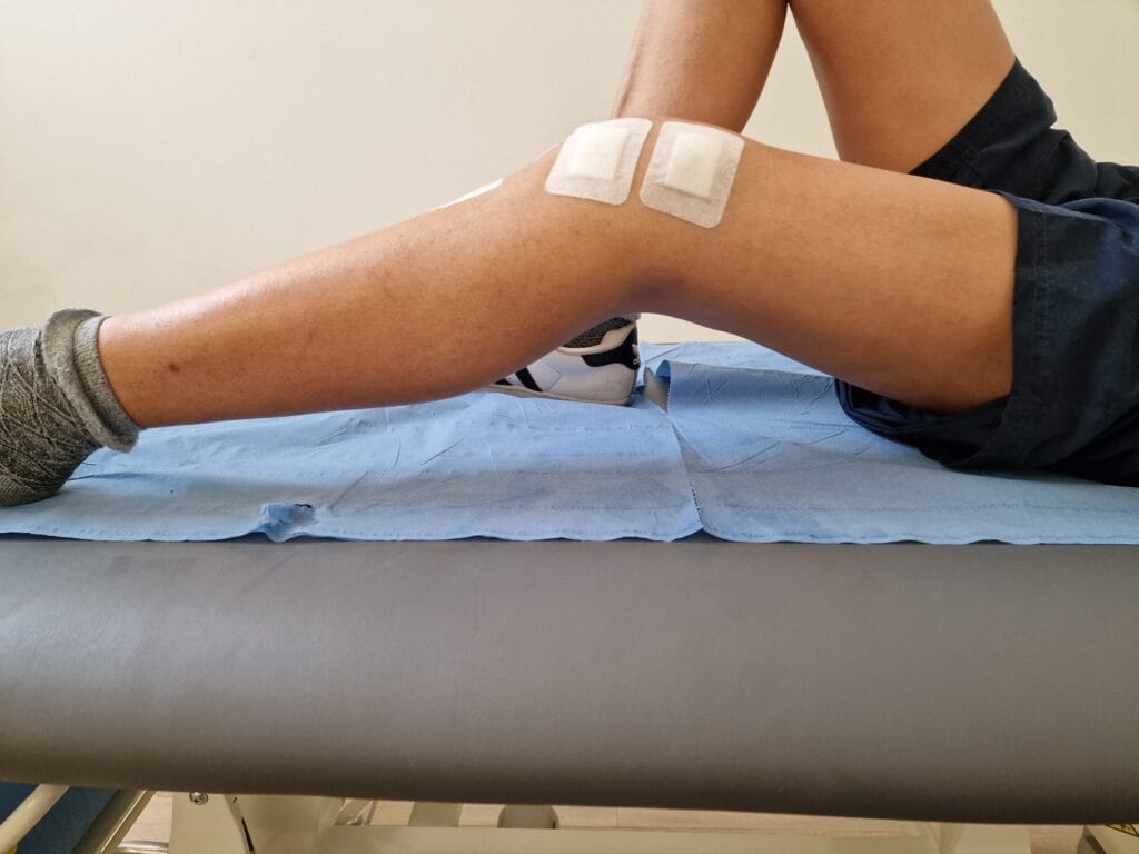 Legamento Crociato Anteriore (LCA): Trattamento e Riabilitazione ...
